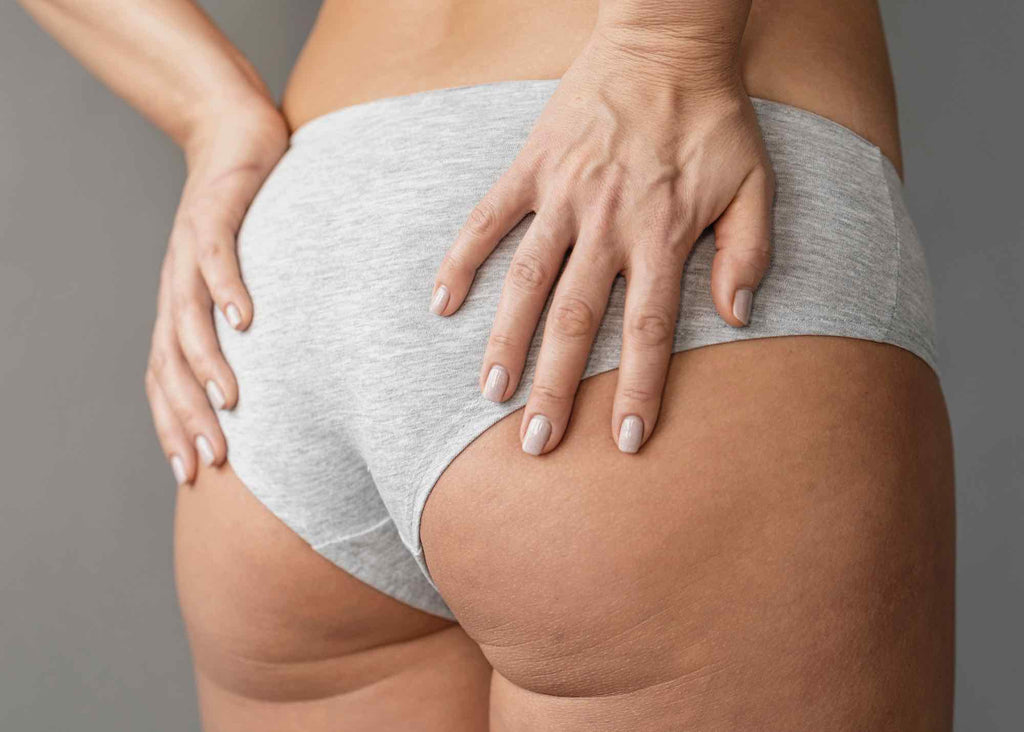 how to get rid of cellulite at home