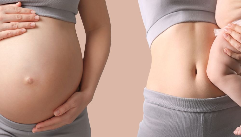 Tighten Loose Skin after Pregnancy
