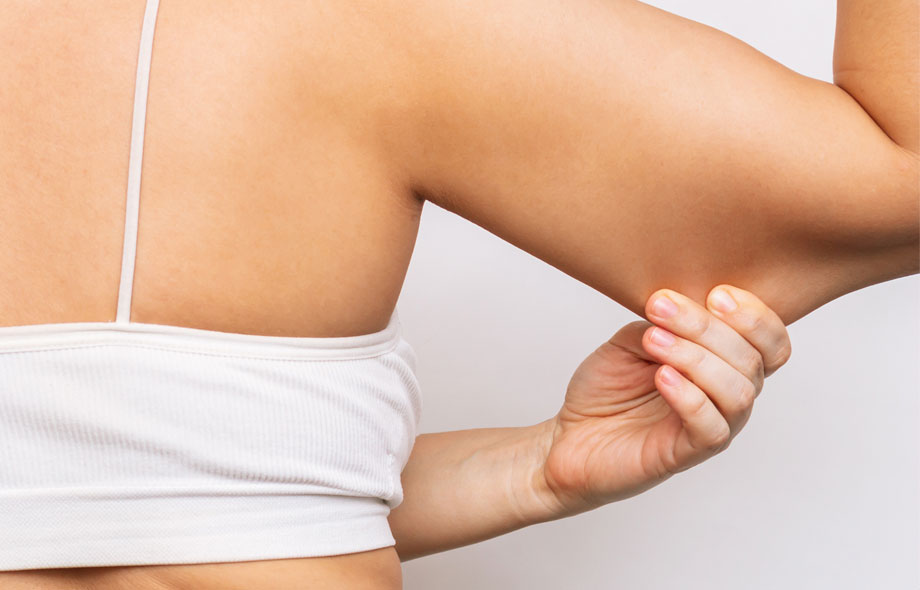 cellulite on arms, saggy arms, flabby arms