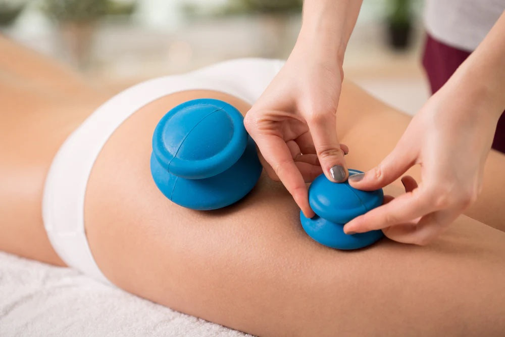 Cupping Therapy for Cellulite