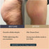 Before and after Guam Mud Seaweed wrap — reduced cellulite and firmer legs after 8 treatments