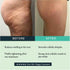 Before and after GUAM Cold Formula wrap — reduced puffiness and firmer legs after 8 treatments