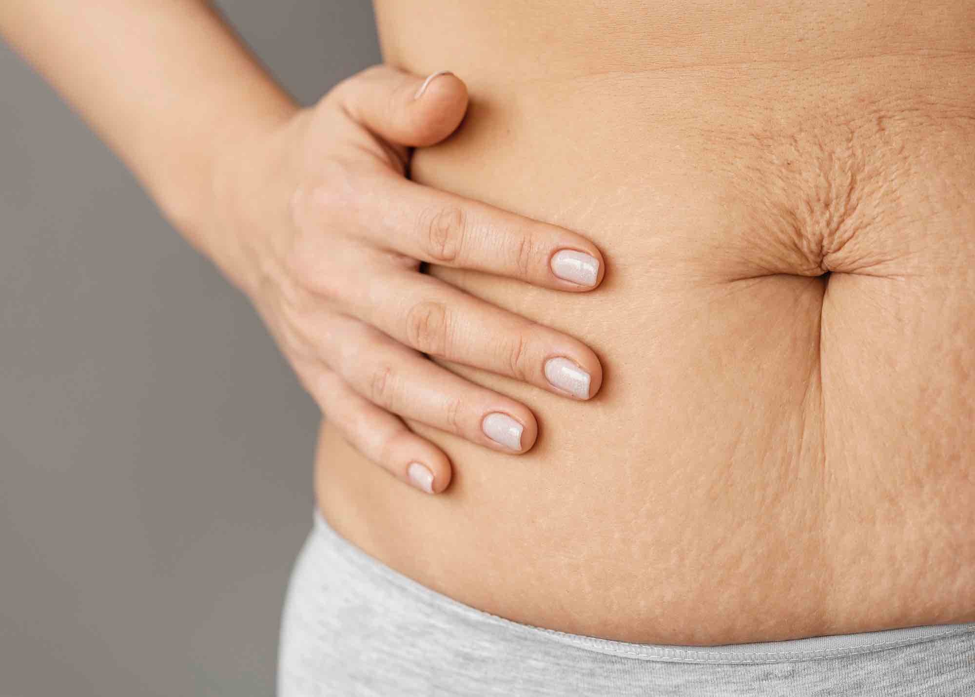 Home Remedies to Tighten Skin on the Stomach. Tips from RAREV