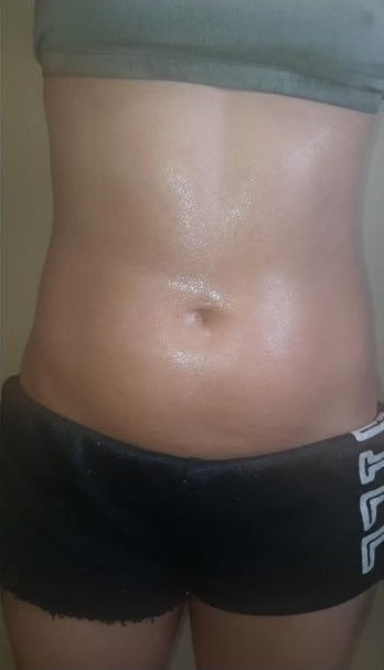 Smoother, firmer stomach after 4 weeks of GUAM Infrared Tummy Wraps for stomach cellulite