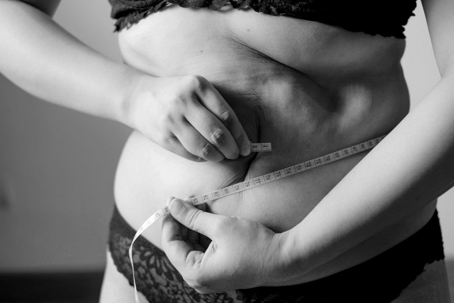 Hands on loose belly skin with stretch marks, where a stomach skin tightening cream works