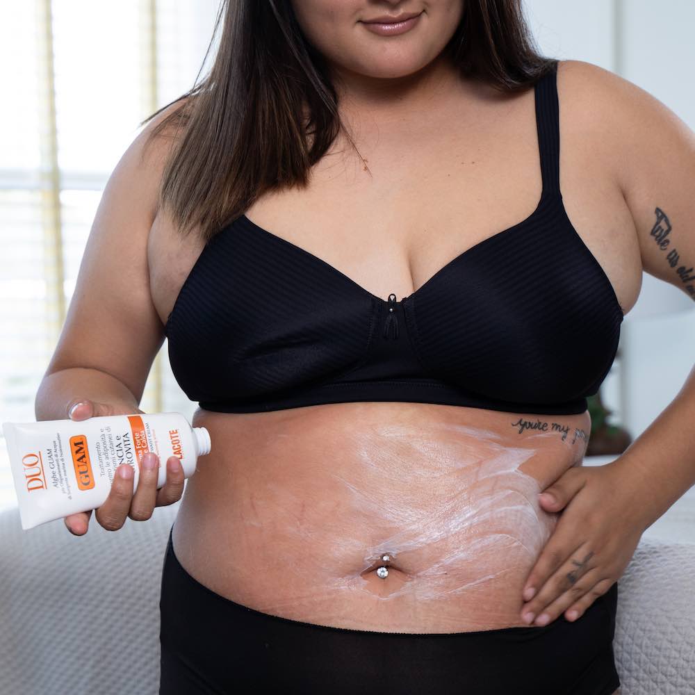 Woman massaging a skin tightening cream into her stomach